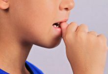 ناخن جویدن کودکان و ارائه 6 روش کاربردی برای ترک ناخون جویدن